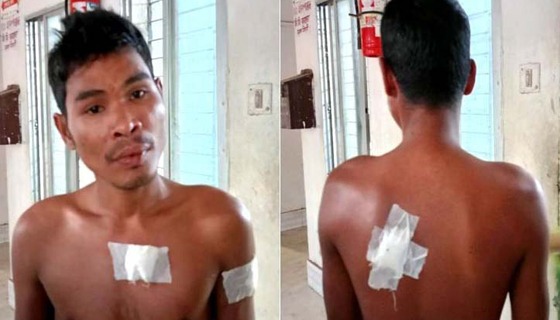 দুর্গাপুরে যুবককে ছুরিকাঘাত